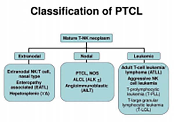 PTCL患者首次缓解后 帕博利珠单抗巩固治疗有效