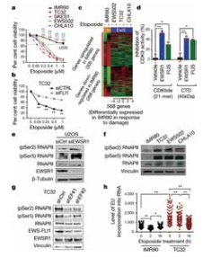 BRCA1与尤文氏肉瘤有关系