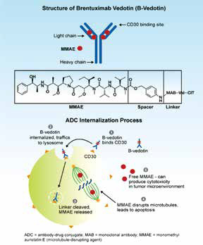  非大包块型Ⅰ~Ⅱ期HL Brentuximab vedotin-AVD方案缓解率较高