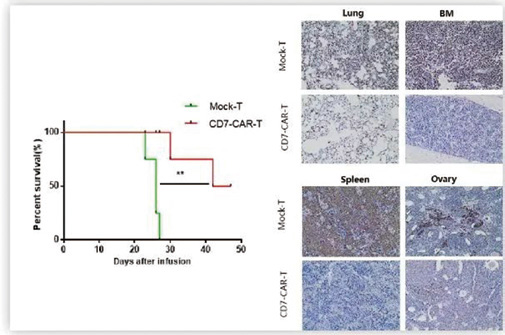 首个自体CD7-CAR-T细胞疗法临床试验获重大突破 