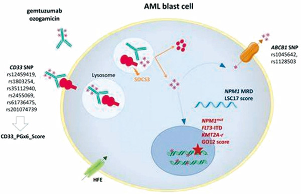 KMT2A-r AML患儿 常规化疗联合Gemtuzumab ozogamicin改善结局