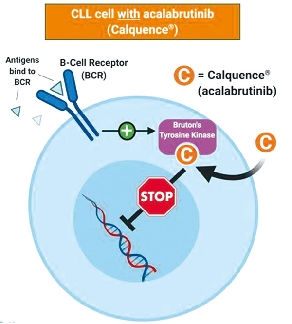 治疗CLL Acalabrutinib或非劣效于依鲁替尼