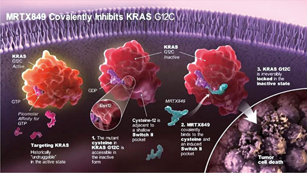 研究发现肿瘤可从腺癌变鳞癌而对KRAS抑制剂耐药