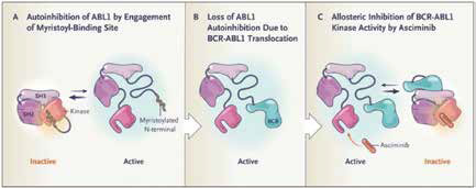 ≥2种TKI耐药或不耐受的CML-CP Asciminib优于Bosutinib