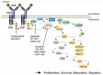 Richter转化的CLL Acalabrutinib单药安全性和疗效研究
