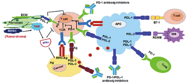合并系统性硬化症患者 抗PD-1/PD-L1治疗癌症仍适宜